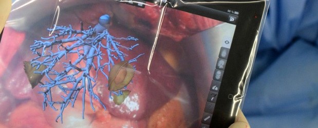 AUBMC doctors conduct first virtually-augmented surgery in the region