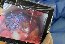AUBMC doctors conduct first virtually-augmented surgery in the region