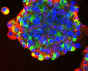 World’s first lab grown stem cells implanted